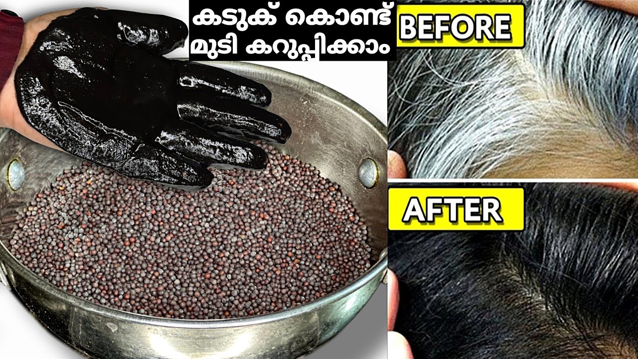 കടുക് കൊണ്ട് നരച്ചമുടി സ്ഥിരമായി കട്ടക്കറുപ്പാക്കാം👌🏻 Hair Dye | Hair Dye Natural