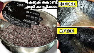 കടുക് കൊണ്ട് നരച്ചമുടി സ്ഥിരമായി കട്ടക്കറുപ്പാക്കാം👌🏻 Hair Dye | Hair Dye Natural