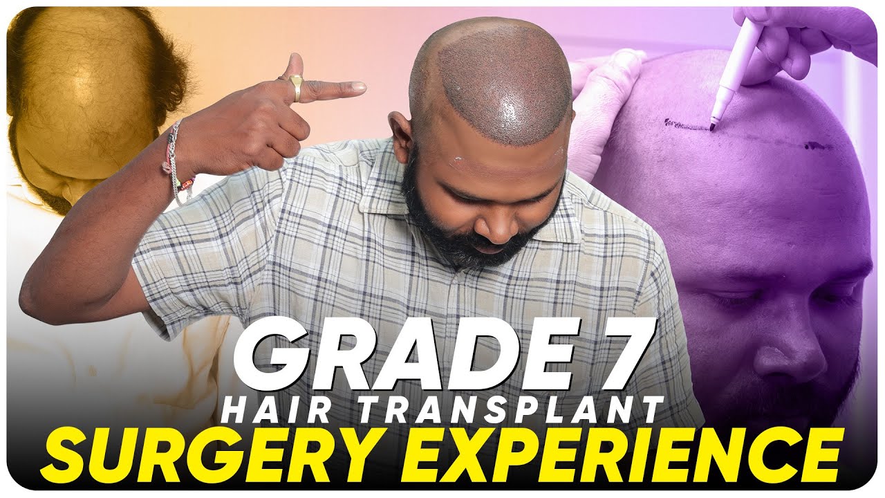 Hair Transplant in Raipur Best Results & Cost of Hair Transplant in
