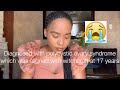 Diagnosed with polycystic ovary syndrome aligned with witchcraft at 17 years | Oko M The Barbie