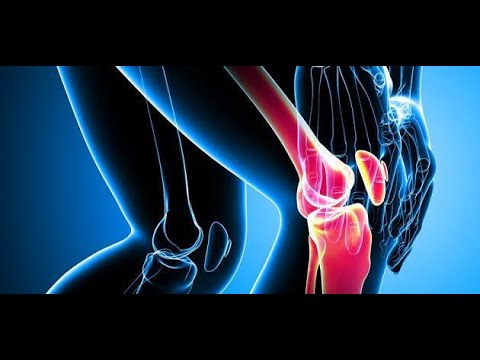 Treatment Of Rheumatism Of Joints | Joints Pain