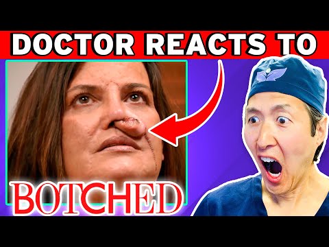 Plastic Surgeon Reacts to BOTCHED! 