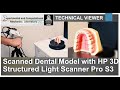 Technical Viewer | Scanned Dental Model with HP 3D Structured Light Scanner Pro S3