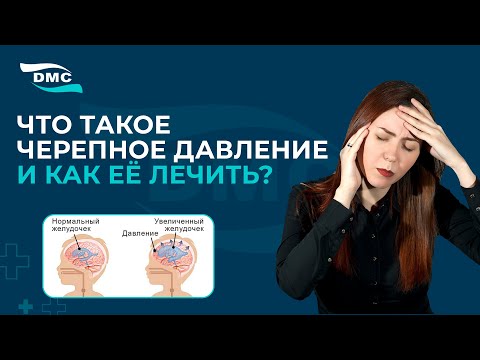 Что такое черепное давление и как её лечить?  #DMC_klinika