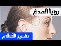 الصدغ في الحلم - تفسير الاحلام لابن سيرين - MR. INFO