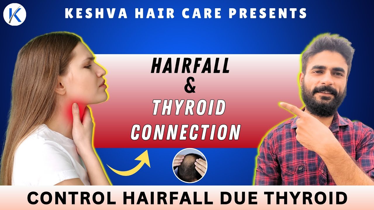 How to Fix Hair Loss from Thyroid Issues | How to Stop Hair fall by ...