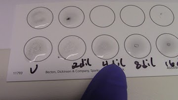 RPR Test (with RPR titer) Part 2