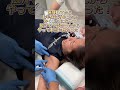 注射嫌いが初めての脇ボトックスやってみた！脇汗でないって最高！