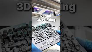 Metal 3D Printing in Dentistry