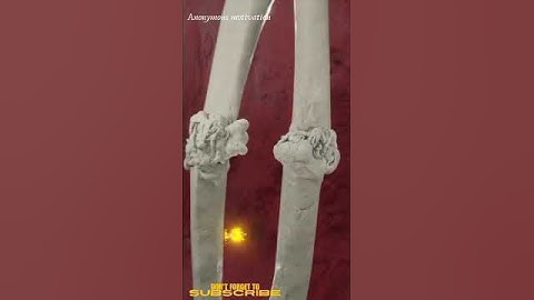 You Should Never Ignore A Broken Bone #anonymousmotivation#3danimation #animation