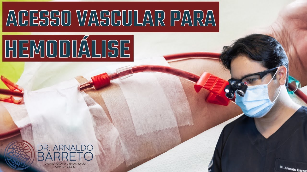 conhe-a-os-tipos-de-acesso-vascular-para-hemodi-lise-lqzw