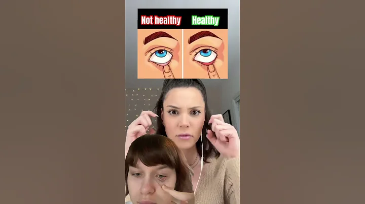 Healthy #shorts #duet #reaction #trending #comedy #funny #greenscreen #green #screen #eyes #skincare