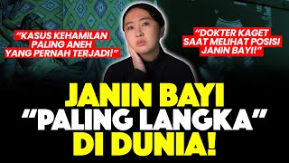 KASUS LANGKA: JANIN TUMBUH DI LIVER SEORANG WANITA