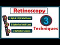 3 techniques of retinoscopy