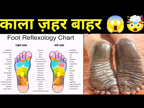 पैरों से निकला काला ज़हर 😱 Foot Reflexology Detox | Joint Pain, Liver, Kidney Truth Dr .P. Choudhary