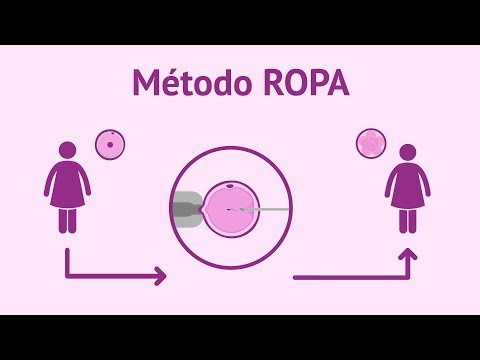 Qué es el método ROPA? - FIV con recepción de óvulos de la pareja