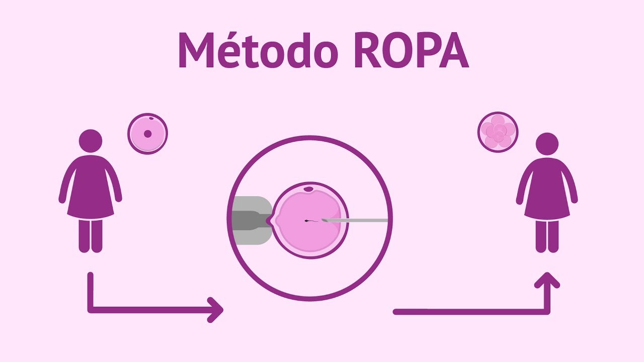Método ROPA | Tratamiento para ser madres lesbianas