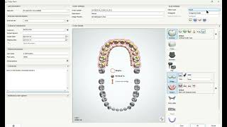 Use 3Shape to design immediate denture 1- create order, import scan