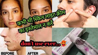 How to Apply Skin Lite Cream in your face |स्किन लाइट क्रीम का उपयोग कैसे करे | कब और कैसे लगायें ? screenshot 2