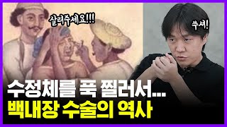 차라리 안 보이는게 더 낫지... | 백내장 수술의 역사