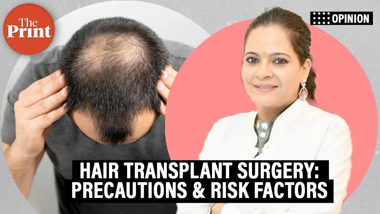 Planning a hair transplant surgery? Here is what you should know