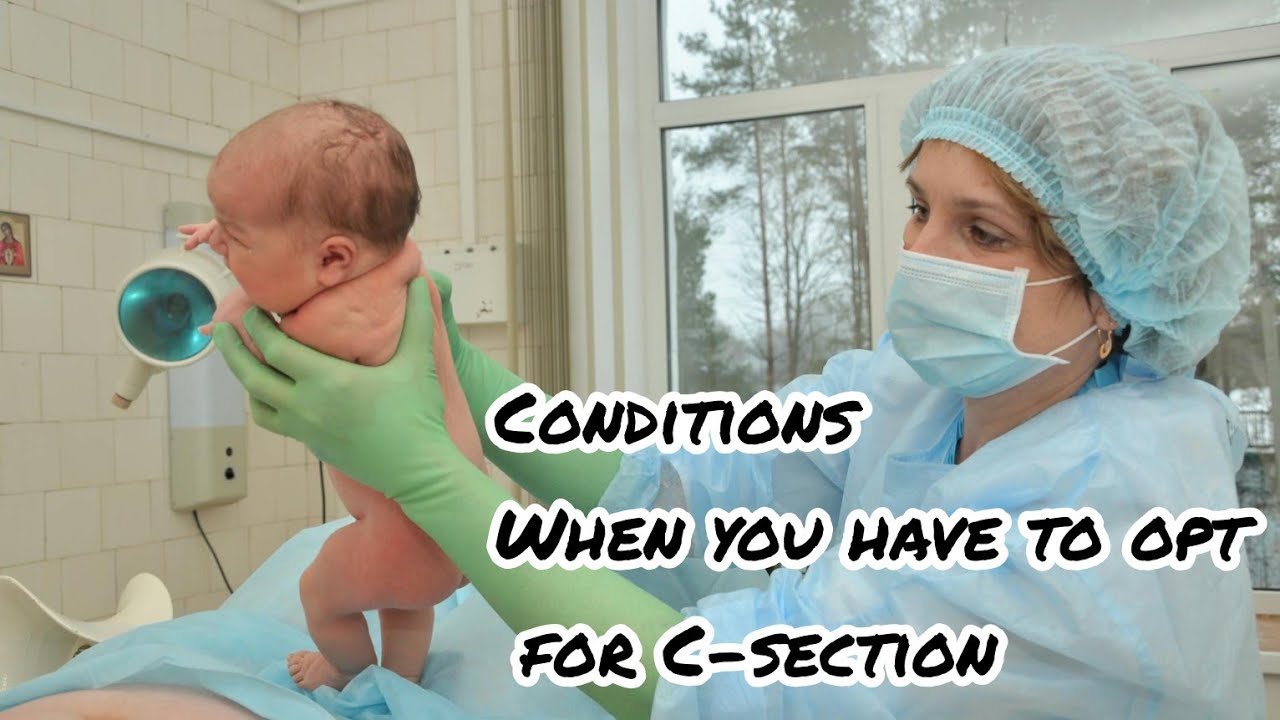 When to have only c-section? | Conditions when we must have opt for c ...
