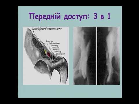 Анатомія попереково-крижового плетення. Коломаченко В.