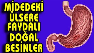 MİDEDEKİ ÜLSERE FAYDALI DOĞAL VE ŞİFALI BESİNLER Resimi