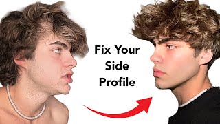 INSTANTLY Fix Your Ugly Side Profile With These 10 Hacks