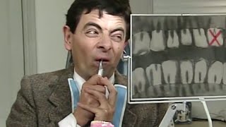 Mr. Bean Operates on Himself | Mr. Bean Official