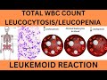 TOTAL WBC COUNT(TLC) NORMAL RANGE, CAUSES OF LEUCOCYTOSIS,LEUCOPENIA, LEUKEMOID REACTION VS LEUKEMIA