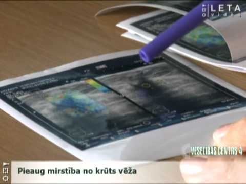 Video: Mirstības Un Mirstības Līmeņa Atšķirība