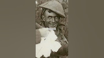 The truth behind the famous shell shock man…