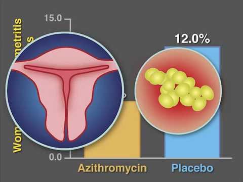 Post-Cesarean Infection and Antibiotic Prophylaxis