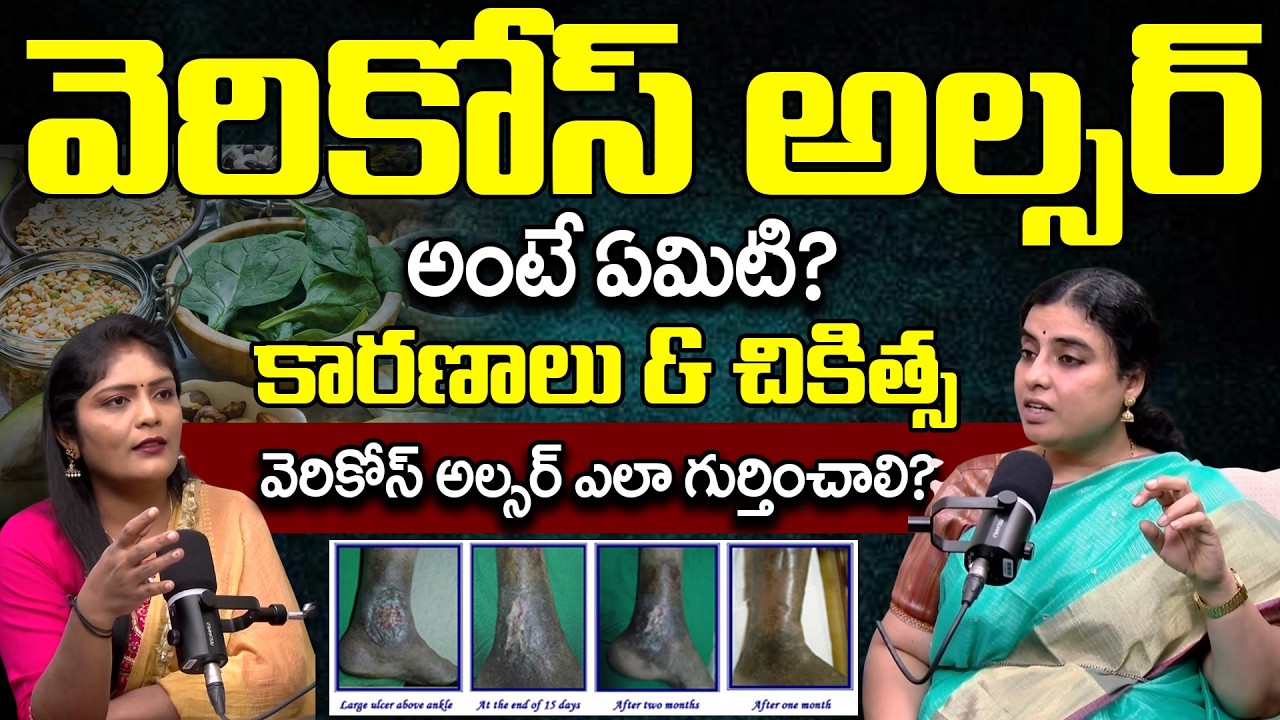 Varicose Ulcer: లక్షణాలు తెలుసుకోండి | How Do Varicose Veins Lead to Ulcers? | @BRK WOMEN HEALTH