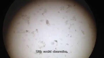 Content of Rumen under Microscope