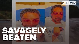 'I'm lost for words': Road rage victim has eyes gouged in brutal assault