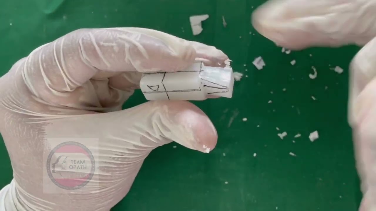 Dental Anatomy Carving - Permanent Maxillary Lateral Incisor