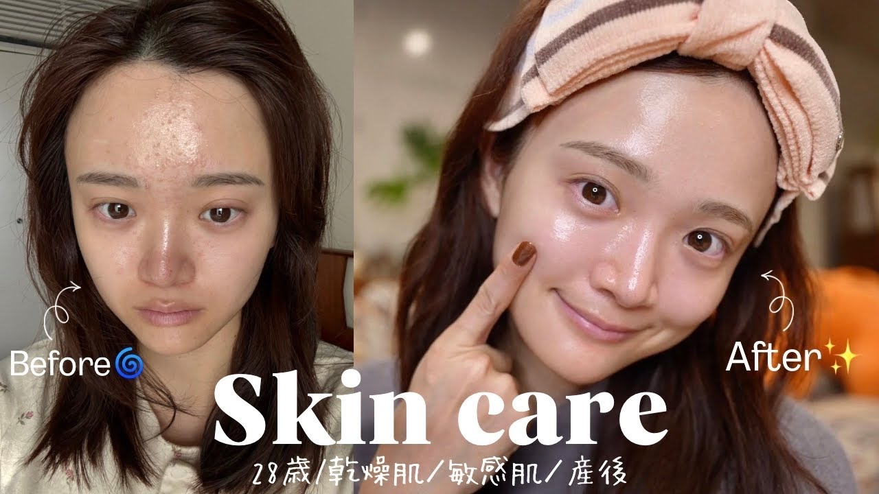 大荒れから褒められ肌に変わったスキンケア✏️🫧