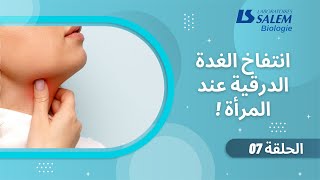 انتفاخ الغدة الدرقية عند النساء