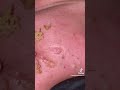 تنظيف بشره عميق راحه نفسيه تنظيف بشره عميق راحه نفسيه