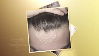 Dr Groot Hair Loss Derma Solution
