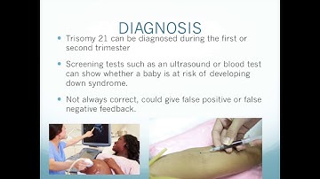 Science video Down syndrome