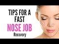 Tips For A Fast NOSE JOB/SURGERY Recovery