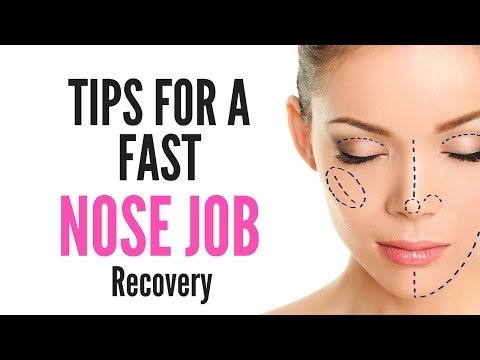 Tips For A Fast NOSE JOB/SURGERY Recovery