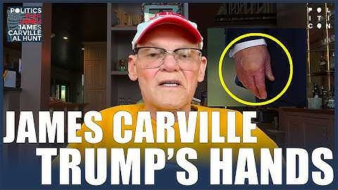 James Carville: What Is Wrong With Trump's Hands