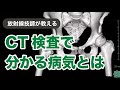 放射線技師が教えるCT検査で分かる病気とは