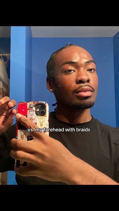  “Your hairline’s receding” no you just don’t know how braids work # ...