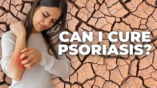 Psoriasis, Everything You Need To Know | The TMI Show