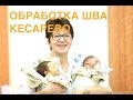 Обработка послеоперационного шва (кесарево сечение) II ОВП